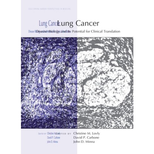 (영문도서) Lung Cancer: Disease Biology and Its Potential for Clinical Translation Hardcover, Cold Spring Harbor Laborato..., English, 9781621823735