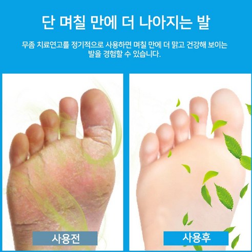 3일 만에 무좀 고민 끝! FDA 승인 무좀약으로 깨끗한 발을 되찾으세요.
