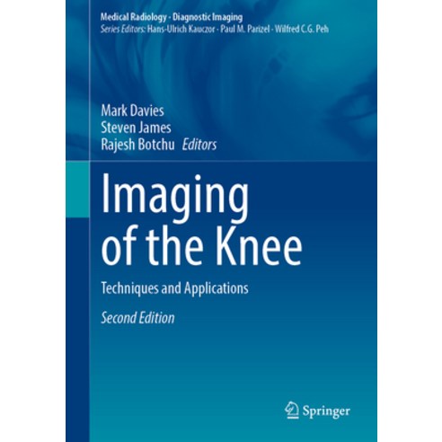 (영문도서) Imaging of the Knee: Techniques and Applications Hardcover, Springer, English, 9783031297304