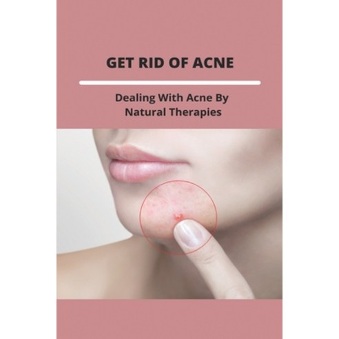 Get Rid Of Acne: Dealing With Acne By Natural Therapies: How To Treat Acne At Home Paperback, Independently Published, English, 9798739000064