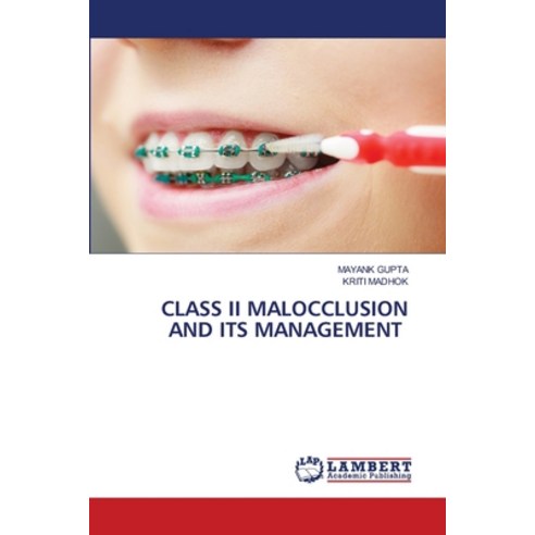 Class II Malocclusion and Its Management Paperback, LAP Lambert Academic Publis..., English, 9786203582086