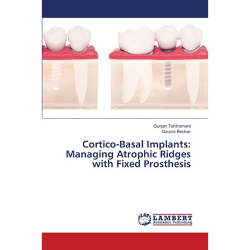 Cortico-Basal Implants: Managing Atrophic Ridges with Fixed Prosthesis Paperback, LAP Lambert Academic Publis..., English, 9786203580983