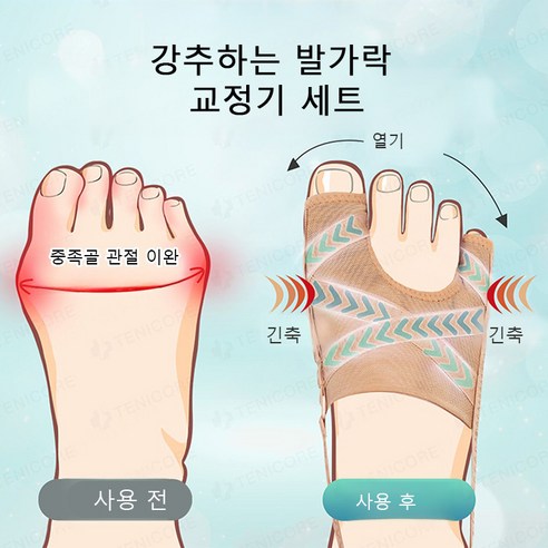 발가락이 편안해지는 마법, [독일의기술] 더 러브 메쉬 무지외반증 교정기 세트