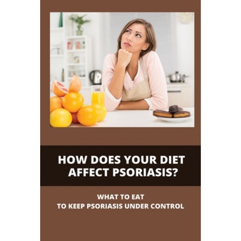 How Does Your Diet Affect Psoriasis?: What To Eat To Keep Psoriasis Under Control: How To Do An Elim... Paperback, Independently Published, English, 9798741304426