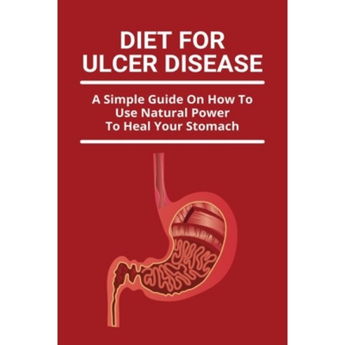 (영문도서) Diet For Ulcer Disease: A Simple Guide On How To Use Natural Power To Heal Your Stomach: Pept... Paperback, Independently Published, English, 9798747061491