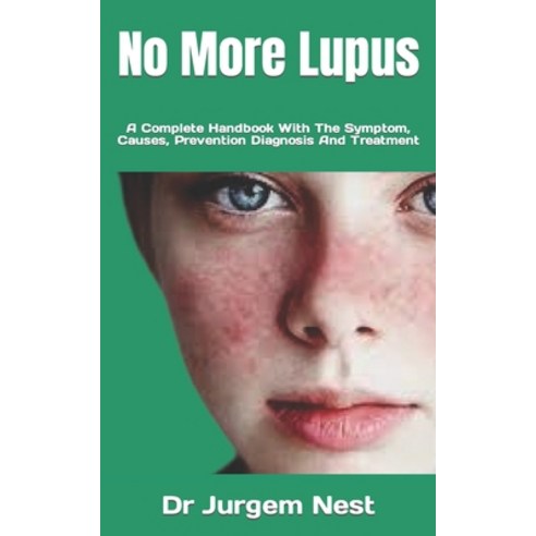 (영문도서) No More Lupus: A Complete Handbook With The Symptom Causes Prevention Diagnosis And Treatment Paperback, Independently Published