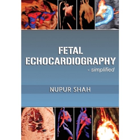(영문도서) Fetal Echocardiography - Simplified Paperback, White Falcon Publishing, English, 9781636408484