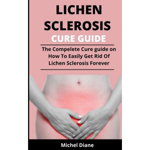Lichen Sclerosis Cure Guide: The Complete Cure Guide On The Causes Manifestations Complexities Dr... Paperback, Independently Published, English, 9798731298254