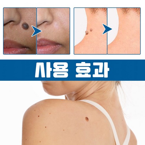 스텔스 패치로 간편하게 피부 문제 해결