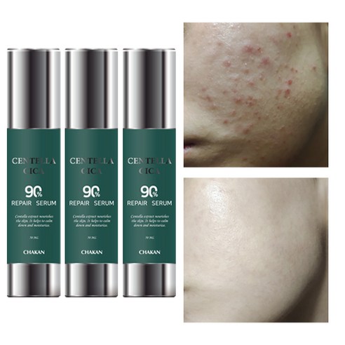 코스알엑스 퓨어 핏 시카 세럼, 30ml, 2개 소나무진정시카앰플 11 기미 잡티 주근깨 미백 진정 시카세럼, 50ml, 1개