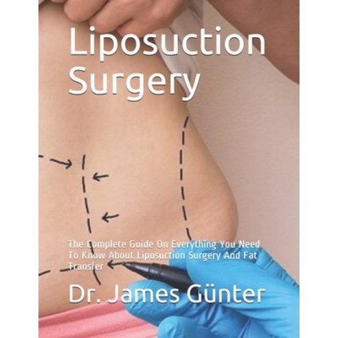 Liposuction Surgery: The Complete Guide On Everything You Need To Know About Liposuction Surgery And... Paperback, Independently Published