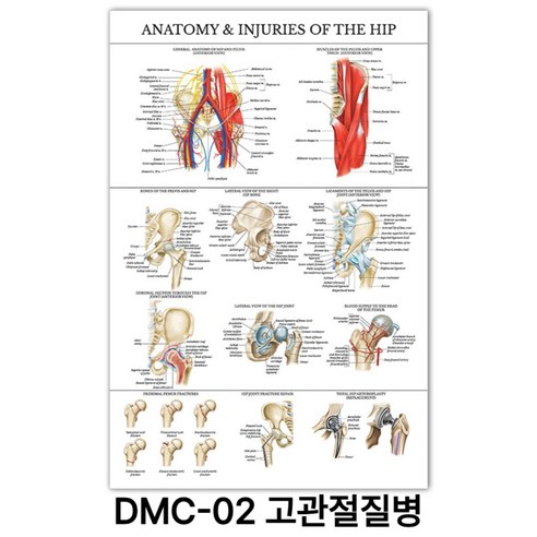 NEW 근육 해부학 포스터, DMC-02 고관절질병