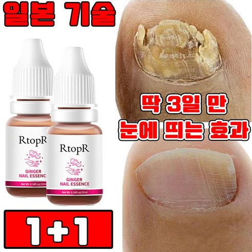 [당일 배송] 1+1/2+2 발톱 무좀 앰플 네일 리페어 발톱 강화 발톱 영양제 문제성 발톱 케어 효과보장, 2개, 10ml