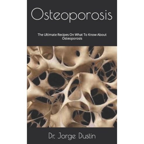 (영문도서) Osteoporosis: The Ultimate Recipes On What To Know About Osteoporosis Paperback, Independently Published, English, 9798483105725