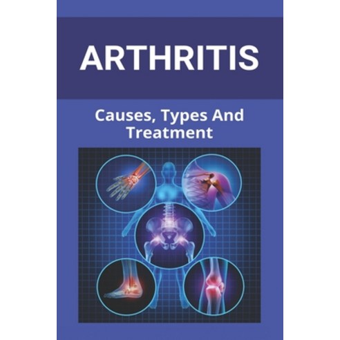 Athritis: Causes Types And Treatment: Arthritis In Hands Paperback, Independently Published, English, 9798747504172