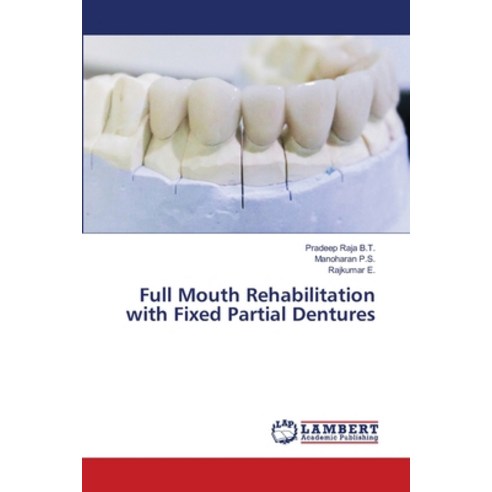 Full Mouth Rehabilitation with Fixed Partial Dentures Paperback, LAP Lambert Academic Publis..., English, 9786203840308