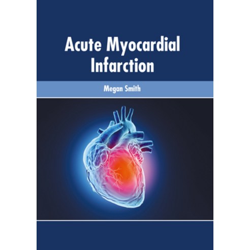 (영문도서) Acute Myocardial Infarction Hardcover, American Medical Publishers, English, 9781639270125