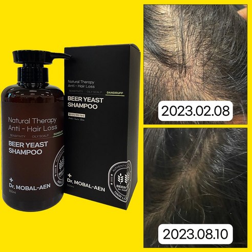 독일탈모샴푸 추천 닥터모발앤 프리미엄 탈모기능성 식약처 인증 맥주효모샴푸 488,000ppm 2023년 BEST상품 TOP10