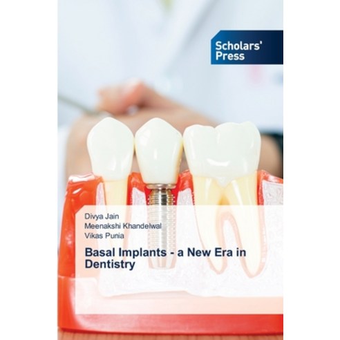 Basal Implants - a New Era in Dentistry Paperback, Scholars'' Press, English, 9786138948353