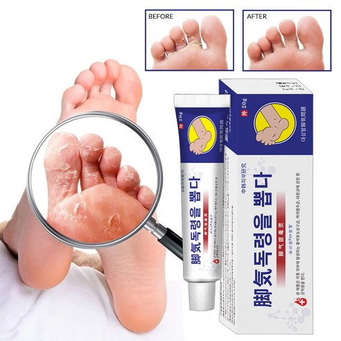 국내산 제품 / 당일 발송 – 연고 피부진정 인텐시브 풋 리페어 크림, 20g, 1개 세타필크림250