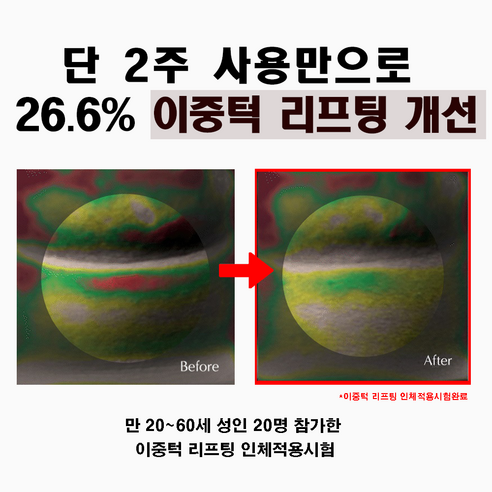 시간의 흔적을 지우고 탄력 있는 피부를 되찾다