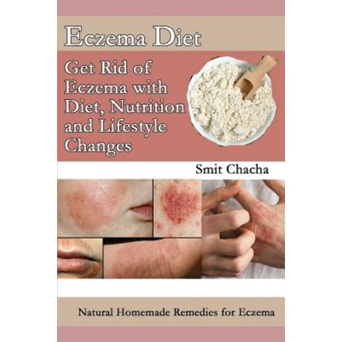 (영문도서) Eczema Diet - Get Rid of Eczema with Diet Nutrition and Lifestyle Changes: Natural Homemade ... Paperback, Independently Published, English, 9781072818793