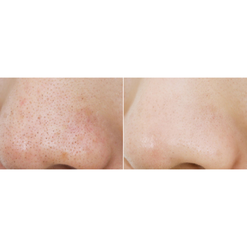 마녀공장 퓨어 클렌징 오일, 깨끗함과 촉촉함으로 완성하는 건강한 피부