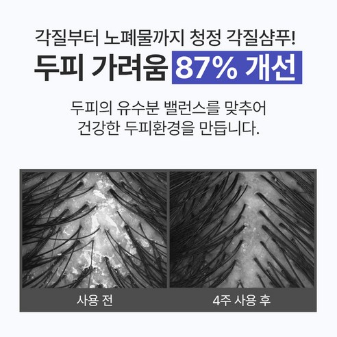 탈모 증상 완화에 도움이 필요한 모든 모발 타입을 위한 천연 탈모 샴푸