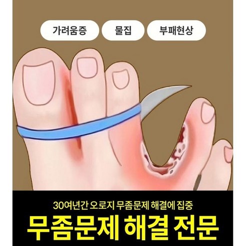 고바야시 무좀 연고로 고통스러운 발, 이제 자유를 되찾으세요!