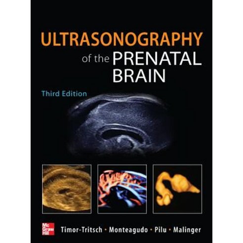Ultrasonography of the Prenatal Brain Hardcover, McGraw-Hill Education / Medical
