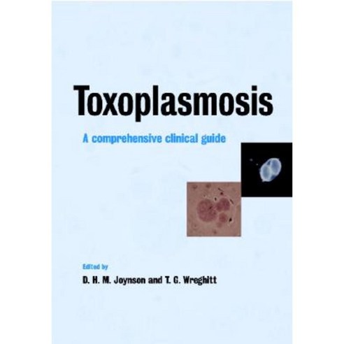 Toxoplasmosis, Cambridge University Press