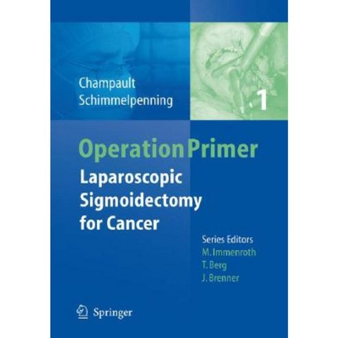 Laparoscopic Sigmoidectomy for Cancer Paperback, Springer