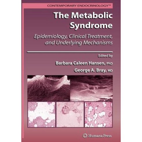 The Metabolic Syndrome:: Epidemiology Clinical Treatment and Underlying Mechanisms Paperback, Humana Press