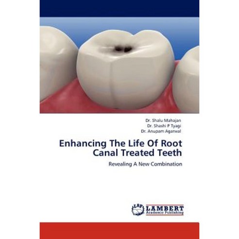 Enhancing the Life of Root Canal Treated Teeth Paperback, LAP Lambert Academic Publishing