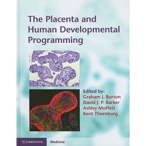 The Placenta and Human Developmental Programming Hardcover, Cambridge University Press