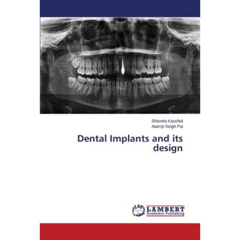Dental Implants and Its Design Paperback, LAP Lambert Academic Publishing