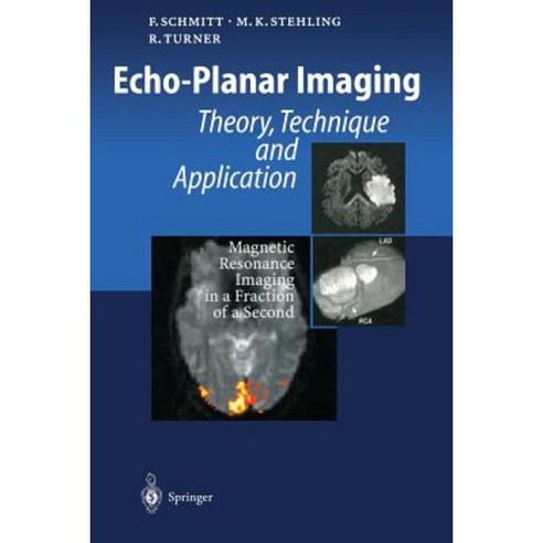 Echo-Planar Imaging: Theory Technique and Application Paperback, Springer
