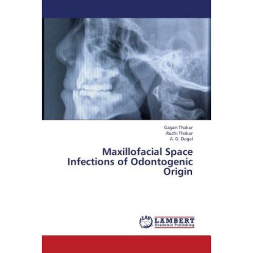 Maxillofacial Space Infections of Odontogenic Origin Paperback, LAP Lambert Academic Publishing