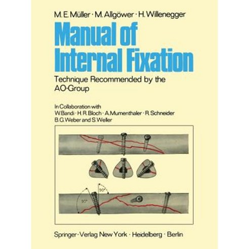 Manual of Internal Fixation: Technique Recommended by the Ao-Group Swiss Association for the Study of Internal Fixation: Asif Paperback, Springer
