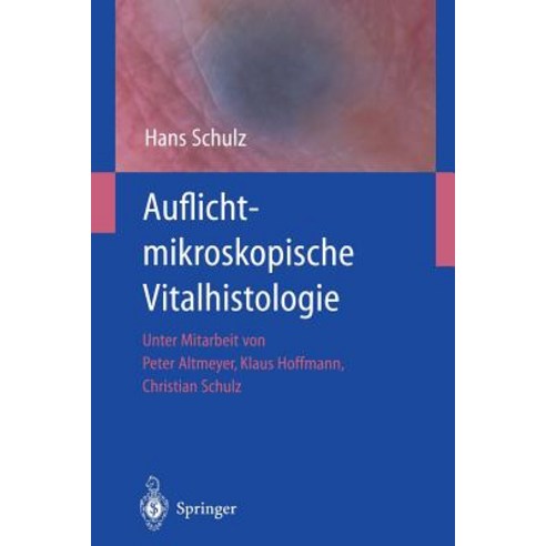 Auflichtmikroskopische Vitalhistologie: Dermatologischer Leitfaden Paperback, Springer