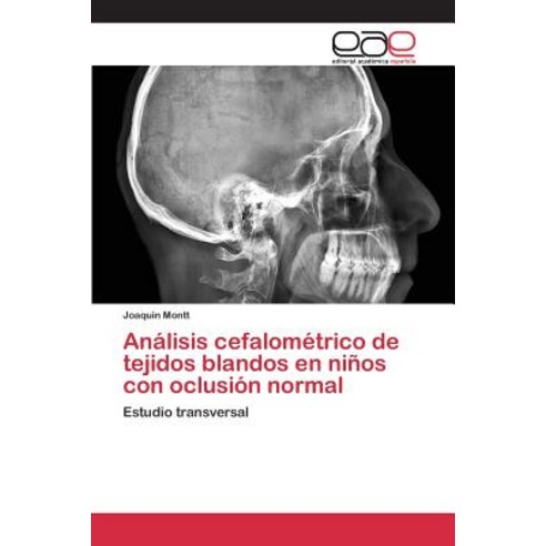 Analisis Cefalometrico de Tejidos Blandos En Ninos Con Oclusion Normal Paperback, Editorial Academica Espanola
