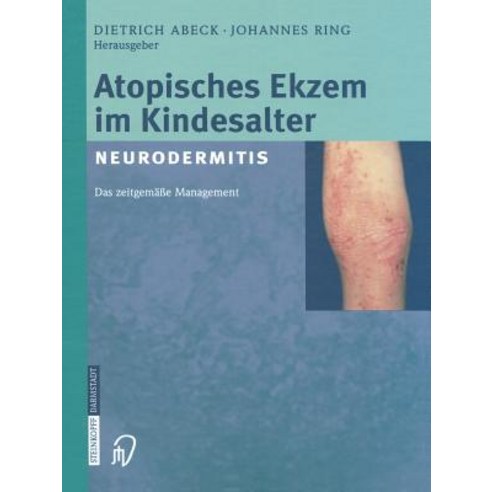 Atopisches Ekzem Im Kindesalter (Neurodermitis): Zeitgemaes Management Paperback, Steinkopff