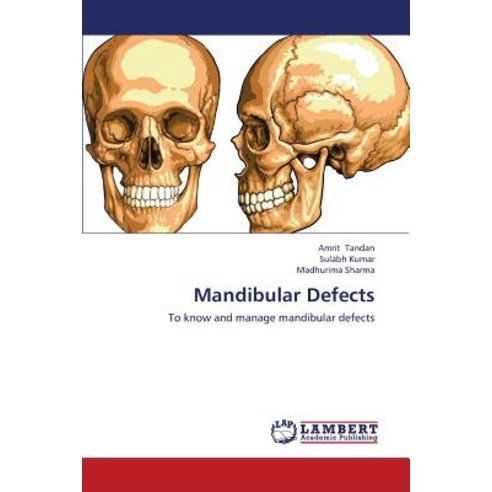 Mandibular Defects Paperback, LAP Lambert Academic Publishing
