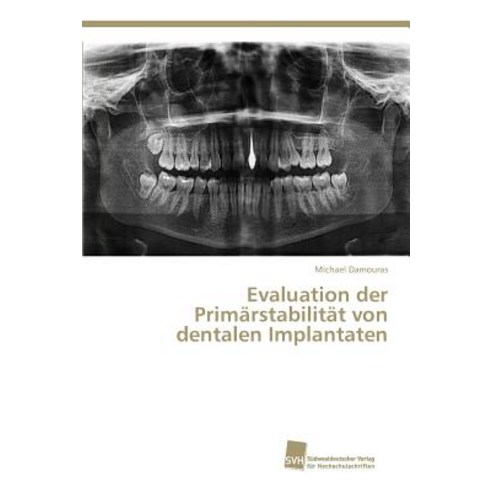 Evaluation Der Primarstabilitat Von Dentalen Implantaten Paperback, Sudwestdeutscher Verlag Fur Hochschulschrifte