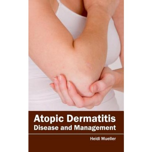 Atopic Dermatitis: Disease and Management Hardcover, Foster Academics