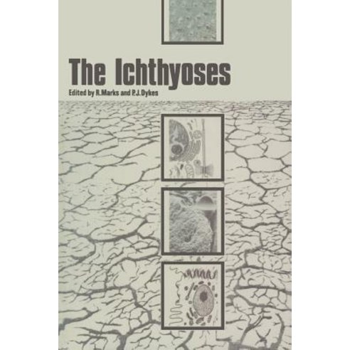 The Ichthyoses: Proceedings of the 2nd Annual Clinically Orientated Symposium of the European Society for Dermatological Research Paperback, Springer