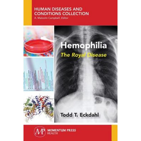 Hemophilia: The Royal Disease Paperback, Momentum Press