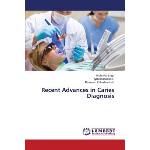 Recent Advances in Caries Diagnosis Paperback, LAP Lambert Academic Publishing