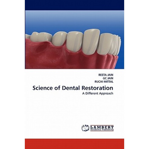 Science of Dental Restoration Paperback, LAP Lambert Academic Publishing