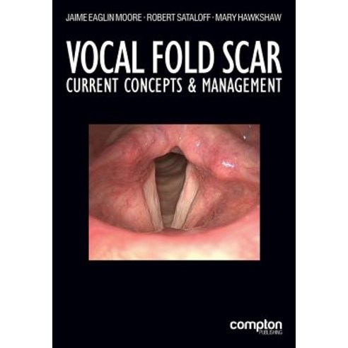 Vocal Fold Scar: Current Concepts and Management Paperback, Compton Publishing Ltd